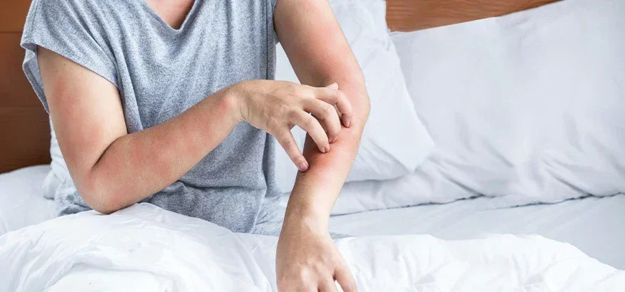 What are Rashes?
