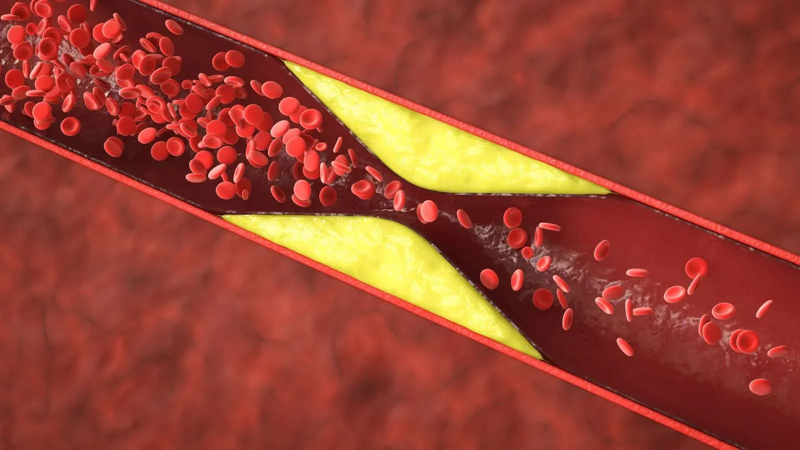 Liposem Tablets: Perfect Ayurvedic Treatment for High Cholesterol