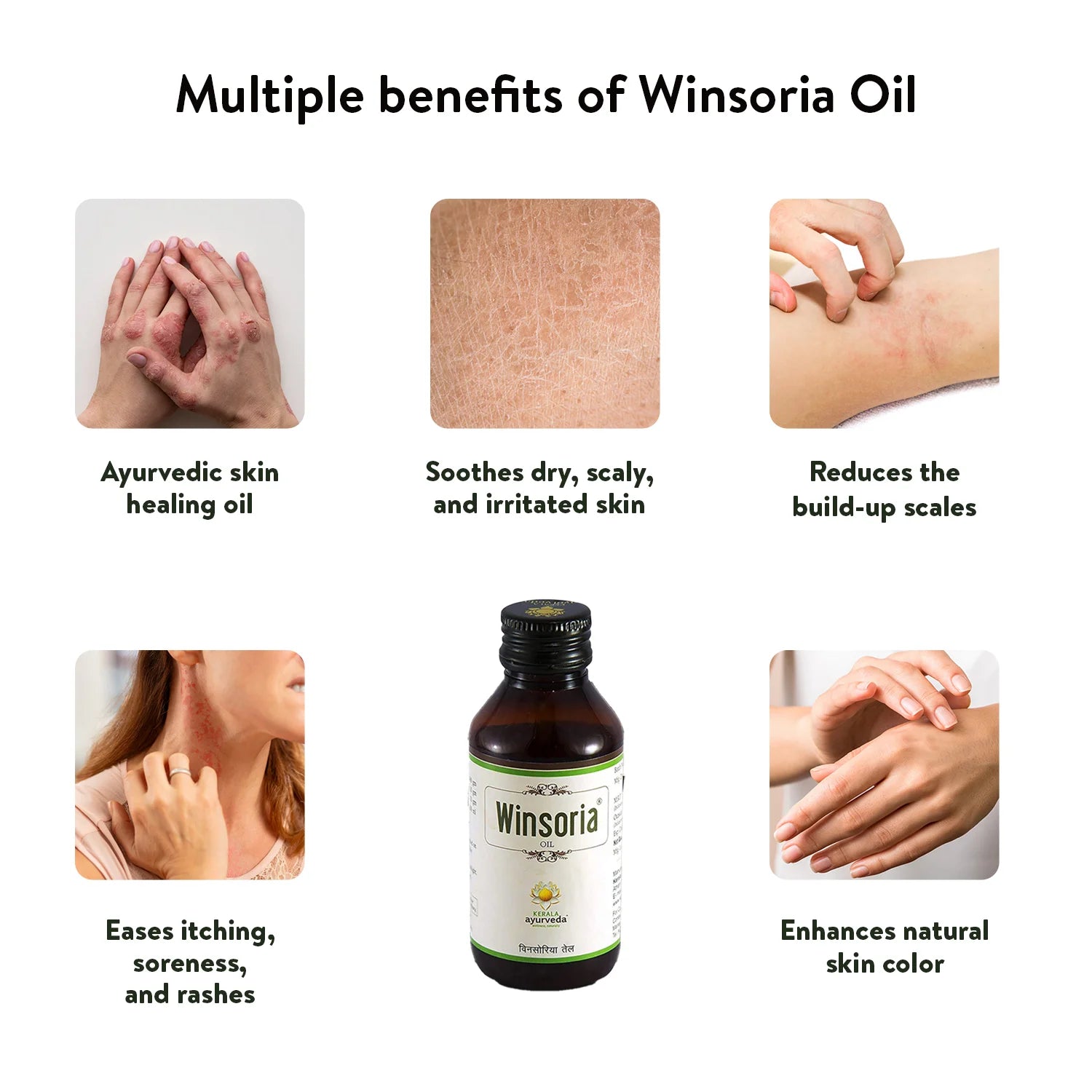 Winsoria Oil (100 ml)